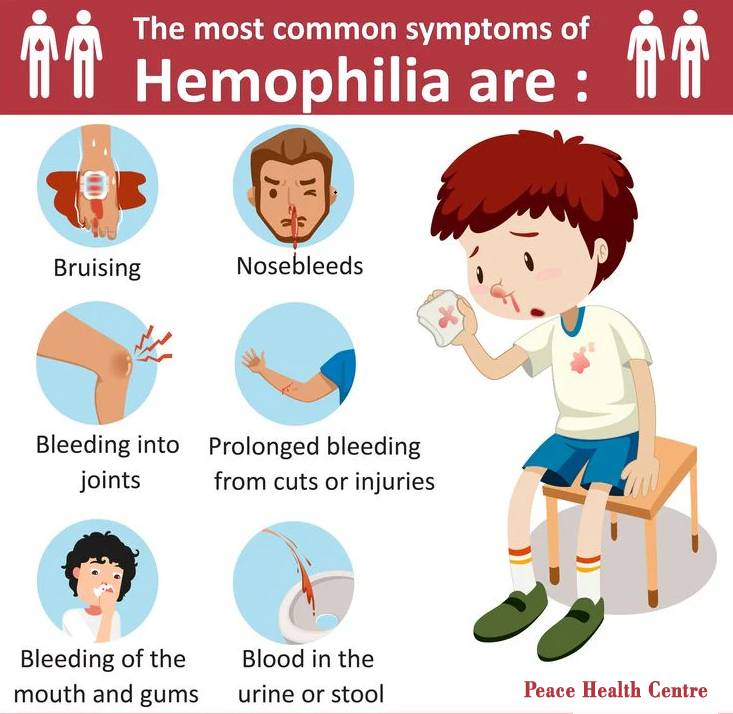 Hemophilia